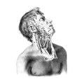 The Castration EP