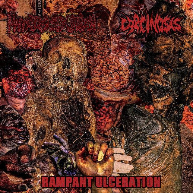 Rampant Ulceration